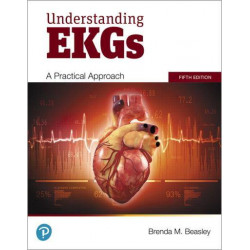 Understanding EKGs: A...